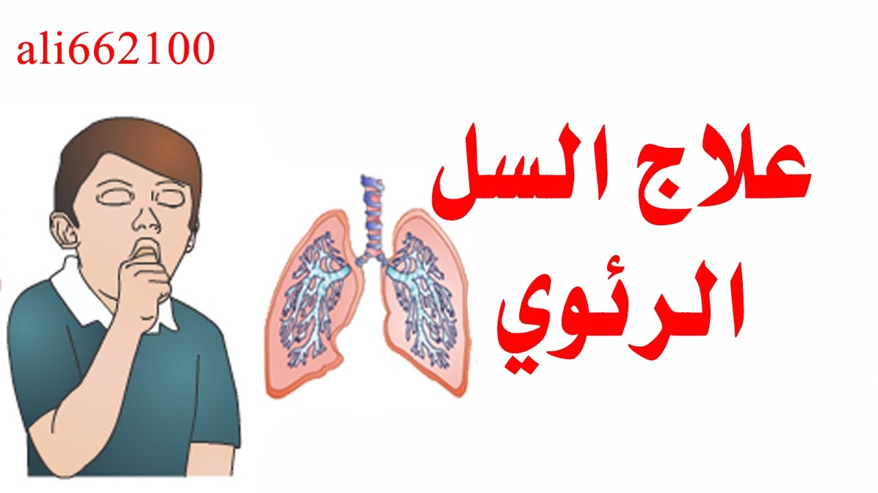 علاج مرض السل - التعرف على هذا المرض اللعين 4626 2