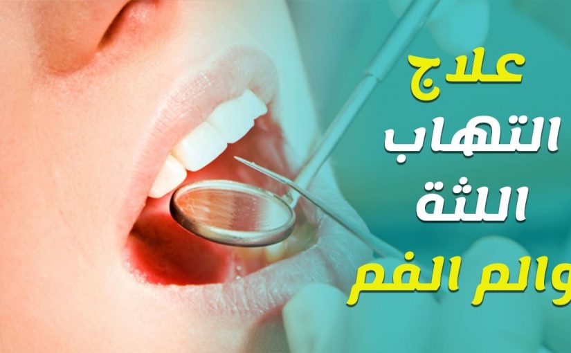 افضل الطرق الطبيعيه علاج اللثه الملتهبه , علاج اللثة الملتهبة