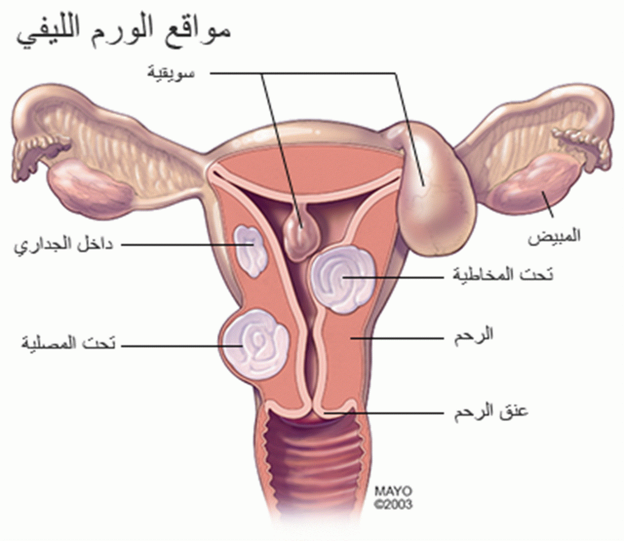 علاج تليف الرحم - اسباب تلف الرحم وطرق علاجه وكيفيه علاجه 7107 1