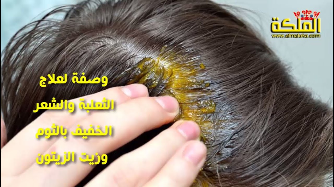 طرق طبيعيه لعلاج الثعلبه - علاج سريع للثعلبة 6130 2