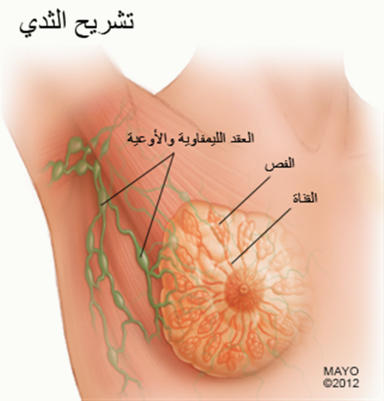 بداية سرطان الثدي - اعراض سرطان الثدي 7255