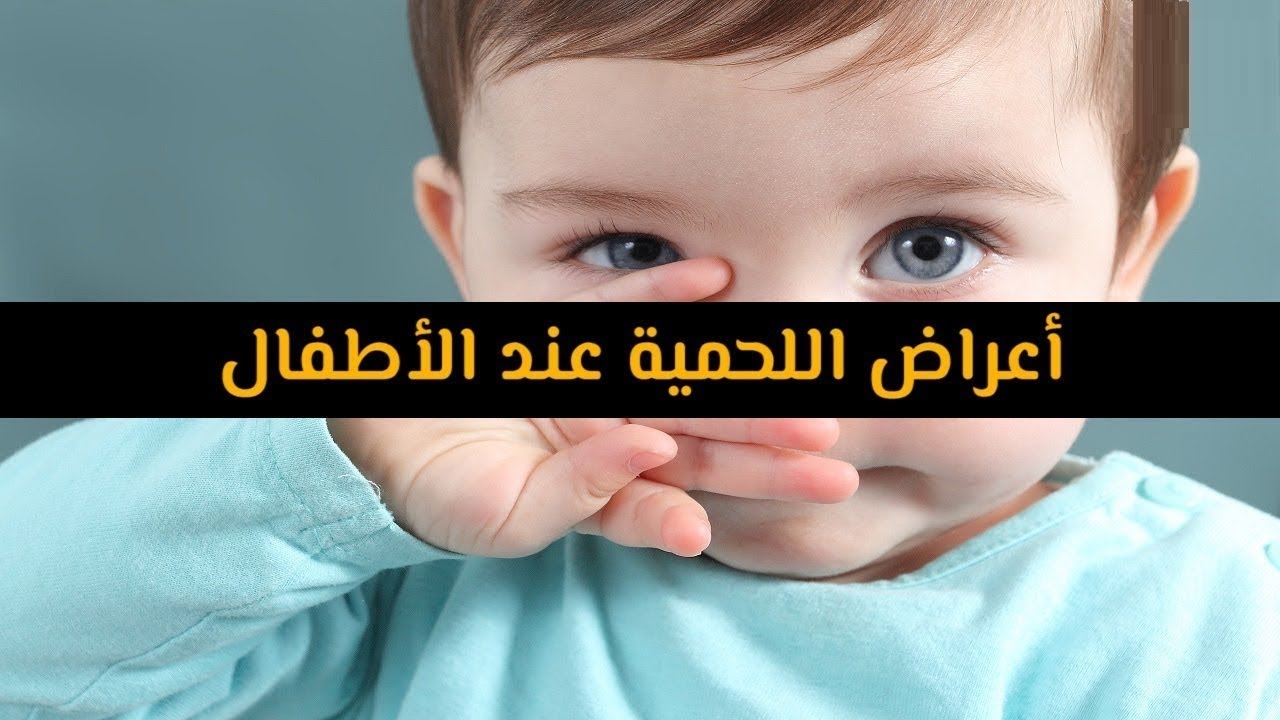 اعراض اللحمية في الحلق - اسباب اللحميه وما هو عرضها 6139 1