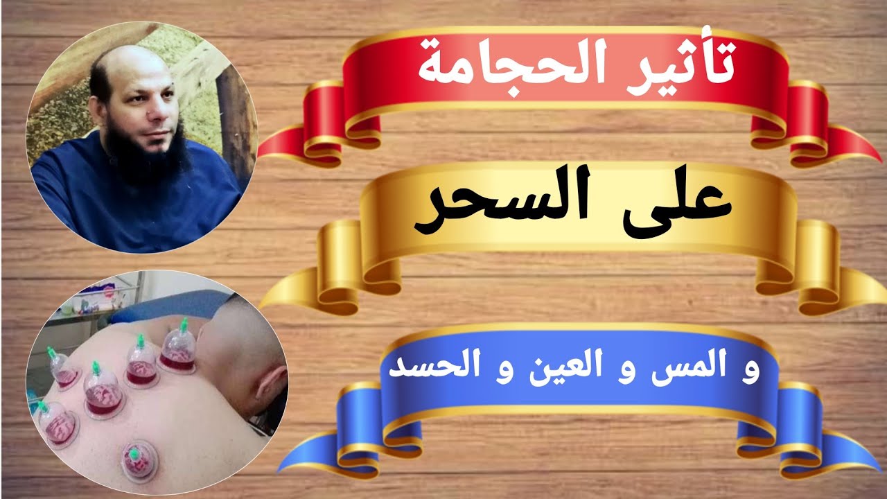 علاج السحر بالحجامة , التخلص من الجن وعلاجه بالجحامه