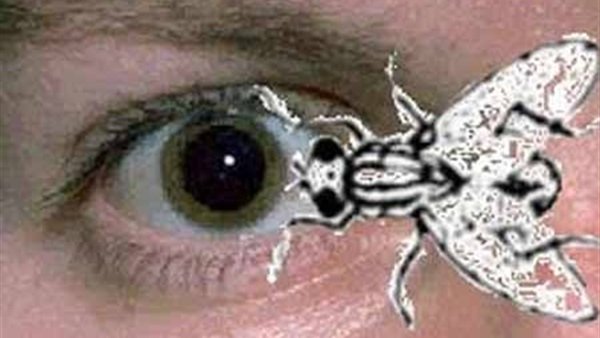 علاج الذبابة الطائرة في العين بالاعشاب , كيفية علاج ذبابة العين - صباحيات